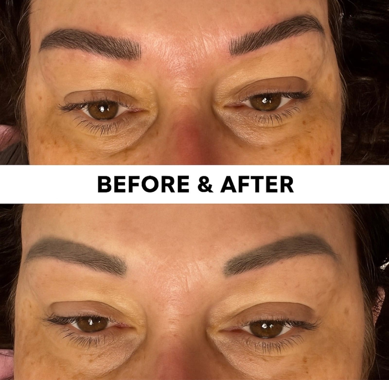 Before and after of an eyebrow correction at BonBrow Aliso Viejo — old harsh microblading softened into natural powder brows